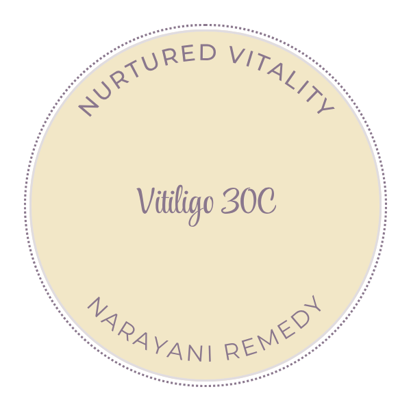 Narayani Vitiligo (Mix 33) 30C