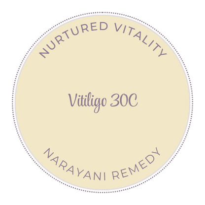 Narayani Vitiligo (Mix 33) 30C